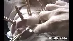 चलाएँ ब्लूइंग एमपोडियम बाद में ग्रेन्युलोज हैंडलिंग